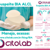 Atualização: Webinar BIA-ALCL no Brasil