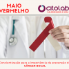 CÂNCER BUCAL - Maio Vermelho / Mês de Luta contra o Câncer Bucal